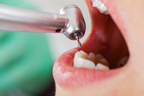 Best Emergency Care for Gum Disease in Asheville, NC